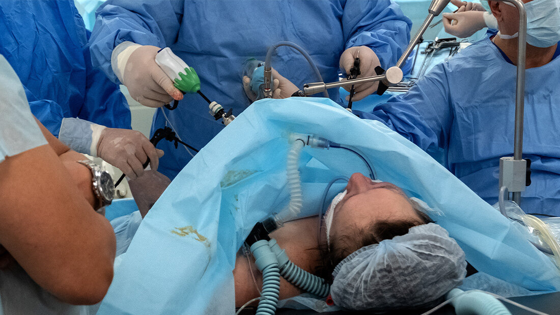 Neue Mindestmengen greifen ab 2024