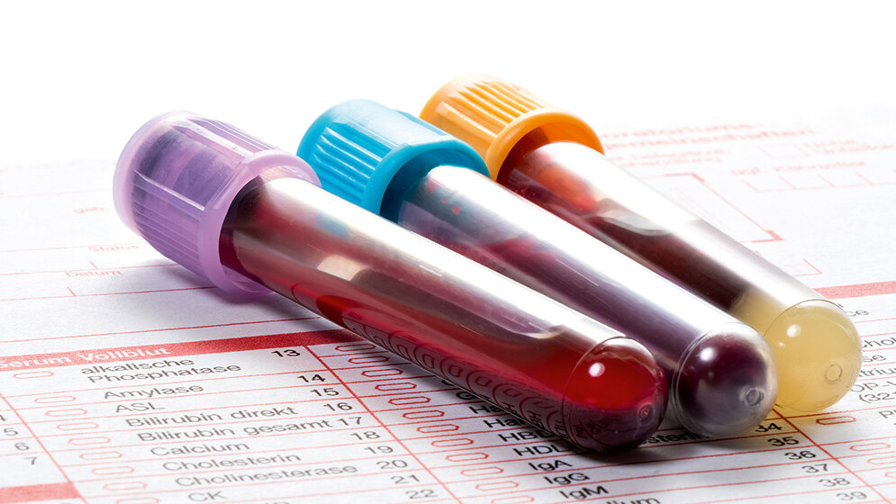 Laboratoriumsmedizin Unter- und Überdiagnostik
in der Labormedizin