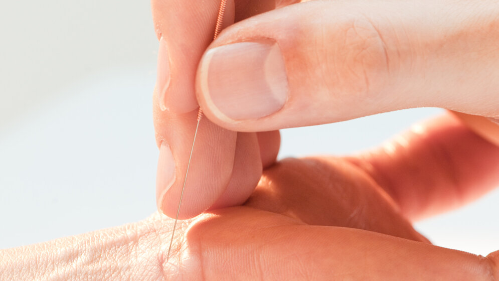 Akupunktur.jpg Komplementärmedizin