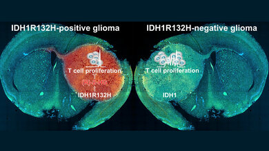 Mutierte_IDH1_L_Bunse_DKFZ.jpg Mutierte IDH1