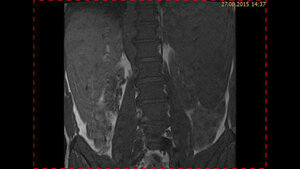 Schnittbilddiagnostik der Wirbelsäule (4.23)