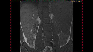 Schnittbilddiagnostik der Wirbelsäule (4.23)