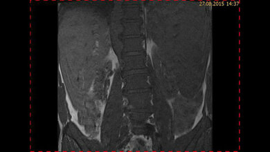 Schnittbilddiagnostik der Wirbelsäule (4.23)