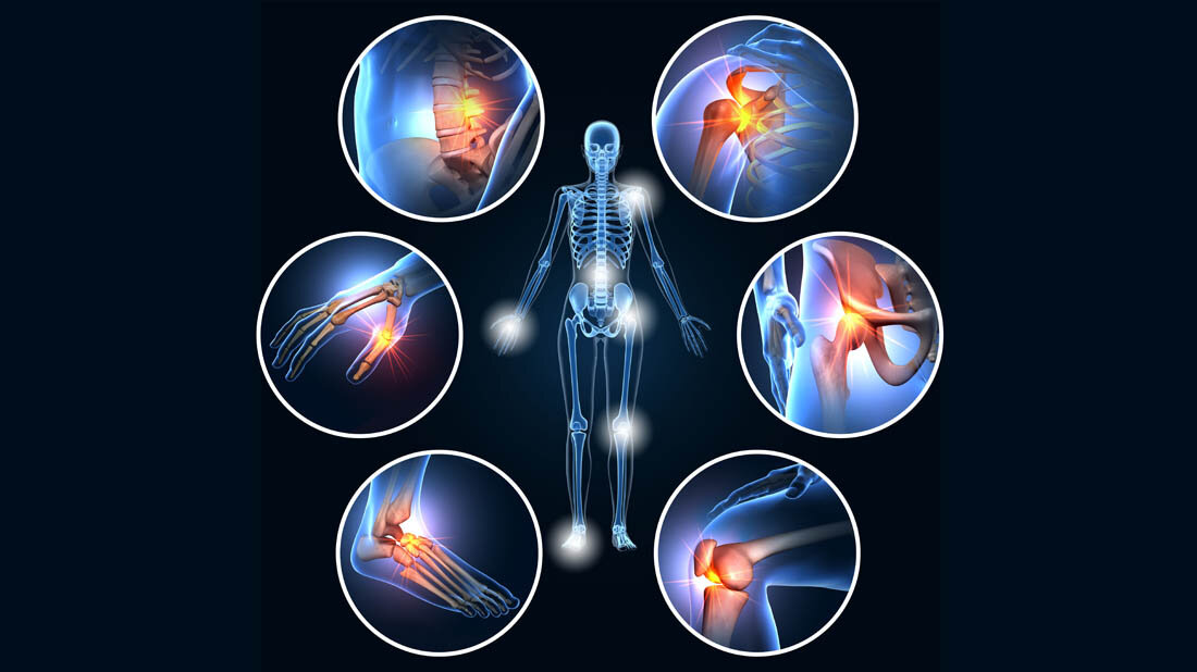 Rheuma_Medikamente.jpg Rheuma