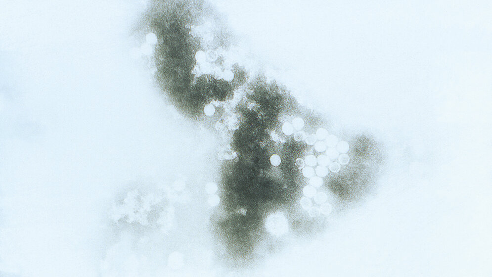 ECHO-Viren – gefährlich für Neugeborene