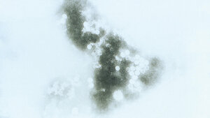 ECHO-Viren – gefährlich für Neugeborene