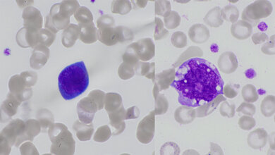 Titelbild zum Fachbeitrag über morphologische Veränderungen der Zellen im peripheren Blutausstrich bei COVID-19