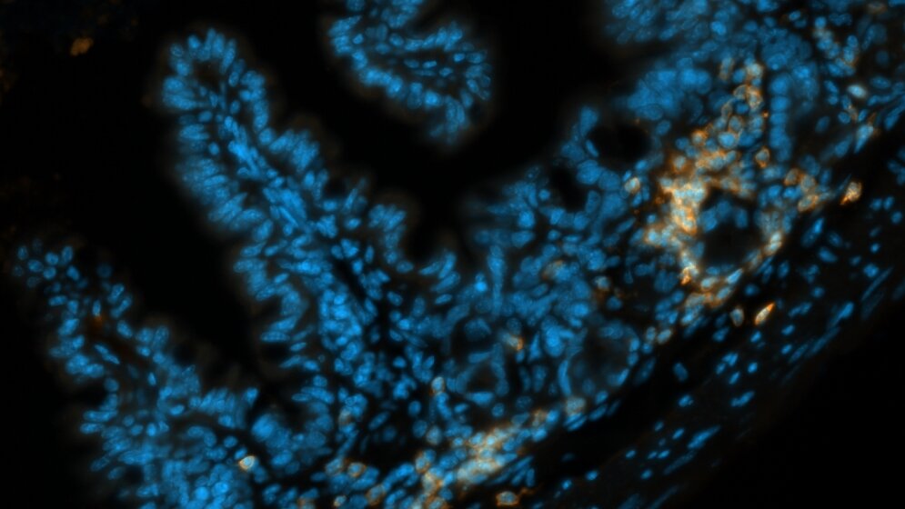 Schnitt durch den Dünndarm