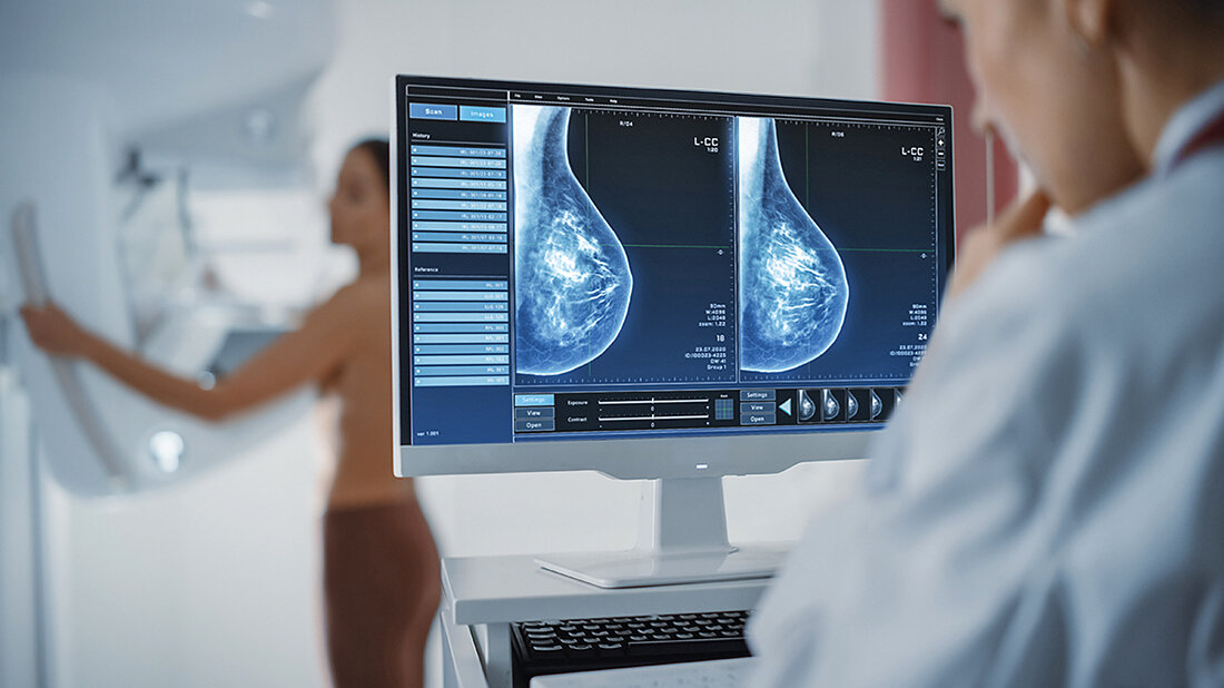 Kontrastmittelverstärkte Mammografie Foto zur Produktvorstellung Röntgenkontrastmittel Ultravist® –300 und –370 von Bayer