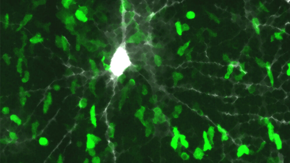 Beta_Synuclein_erkennende_T_Zellen_stuermen_die_graue_Hirnsubstanz_Institut_für_Neuroimmunologie_und_MS_Forschung_Goettingen.jpg Beta-Synuclein-erkennende T-Zellen