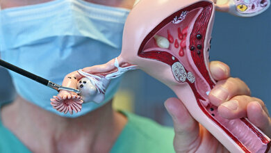 Demonstration der Eileiterentfernung am Modell