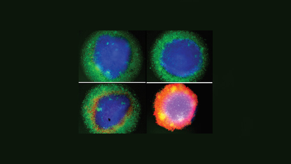 Fluroeszenzmikroskopie_von_Brustkrebs_Organoiden_Momburg_DKFZ.jpg Fluroeszenzmikroskopie von Brustkrebs-Organoiden