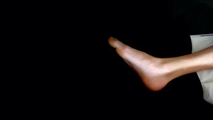 Häufigkeit und Komplikationen der Staphylococcus-aureus-Sepsis bei Kindern