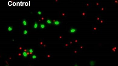 α-Synuklein-Ansammlungen 
