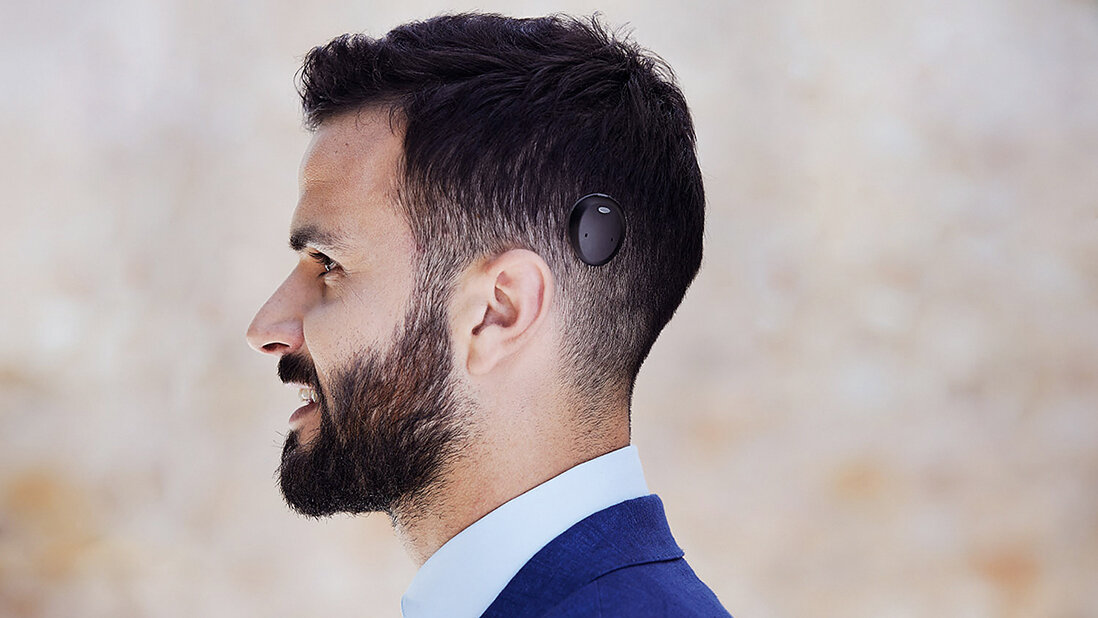 Titelbils zur Produktvorstellung Cochlear™ Osia® System