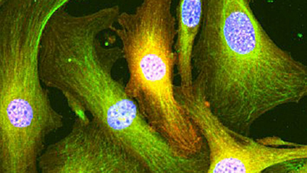 Goettinger_Forscher_entwickeln_neue_Methode_umg.jpg Göttinger Forscher entwickeln neue Methode