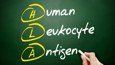 Beschreibung von HLA