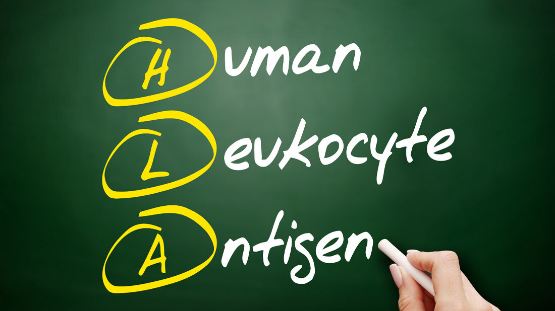 Beschreibung von HLA