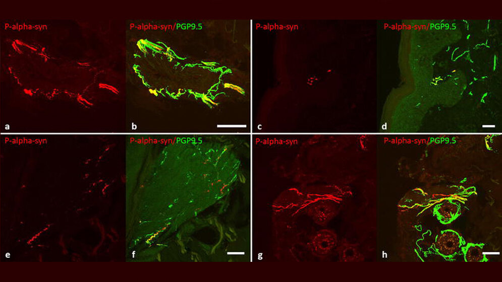 Konfokale Mikrophotographien