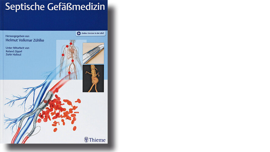 Septische Gefäßmedizin
