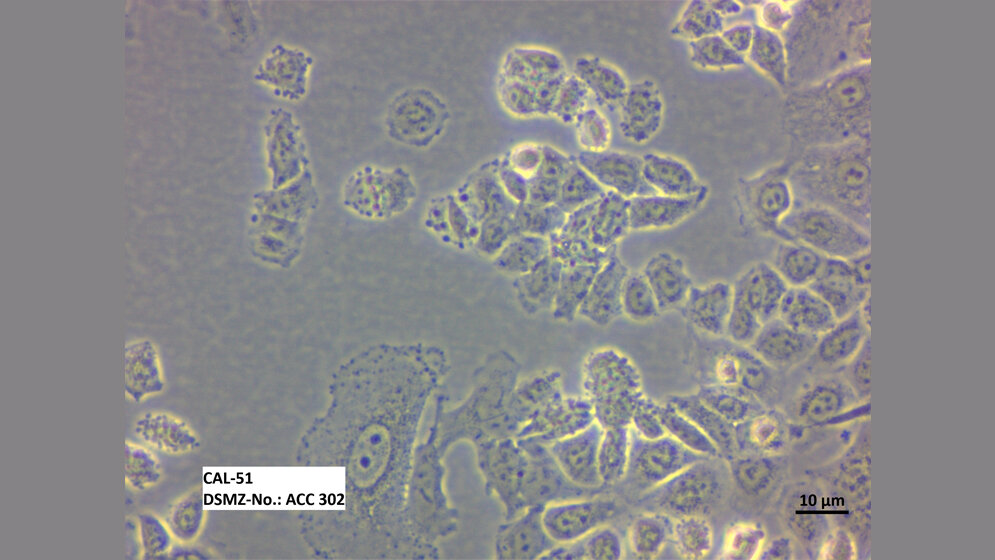 Zelllinie CAL-51 (ACC 302) 