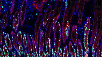 Mit Helicobacter-Bakterien infiziertes Magengewebe.