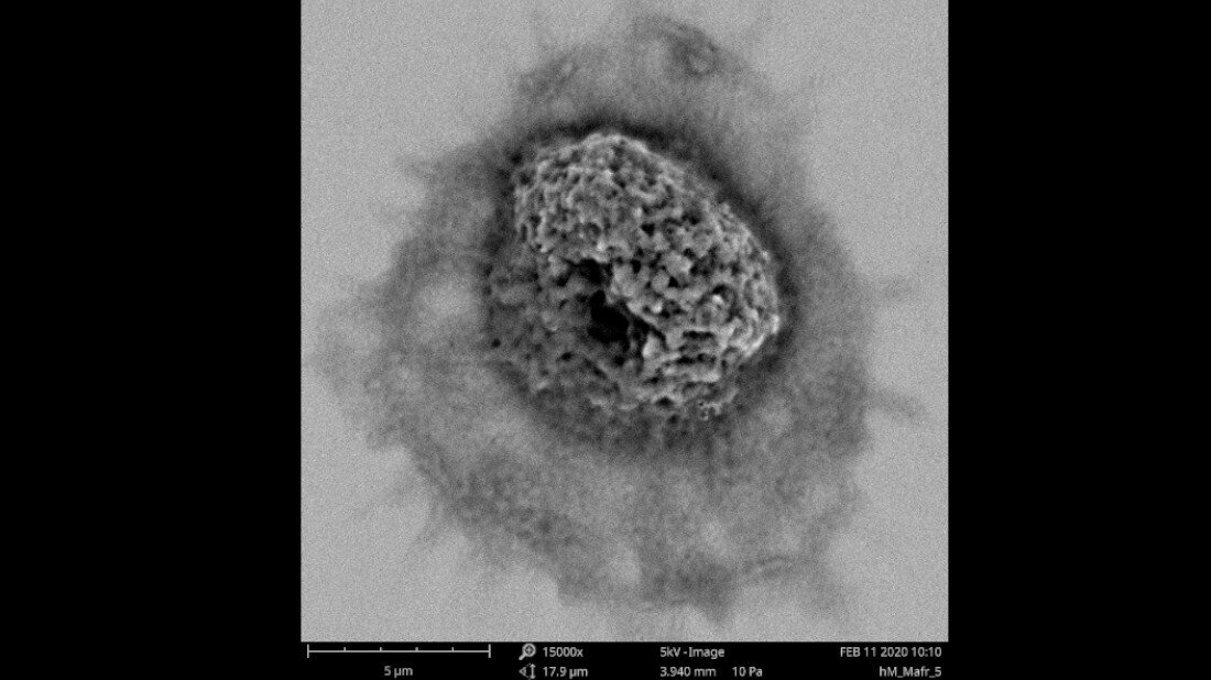 Makrophage.jpg Rasterelektronenmikroskopische Aufnahme eines humanen Makrophagen in 15000facher Vergrößerung