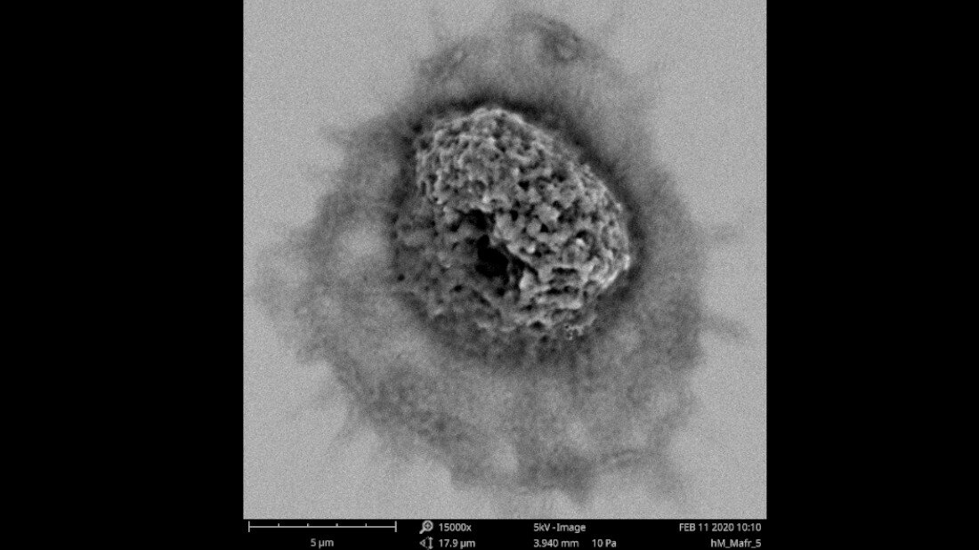 Rasterelektronenmikroskopische Aufnahme eines humanen Makrophagen in 15000facher Vergrößerung 