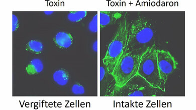 Auswirkungen von Clostridioides difficile