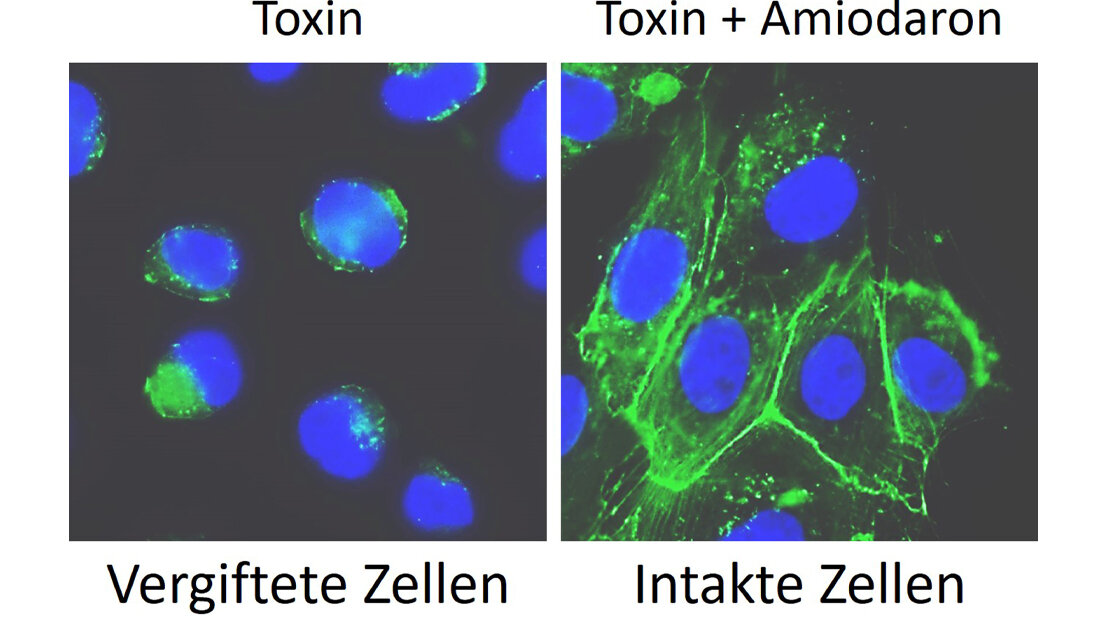 Auswirkungen von Clostridioides difficile