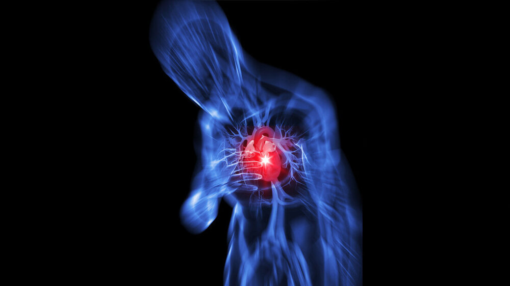 Herzinfarkt_01.jpg Symbolbild für Person mit Herzinfarkt.