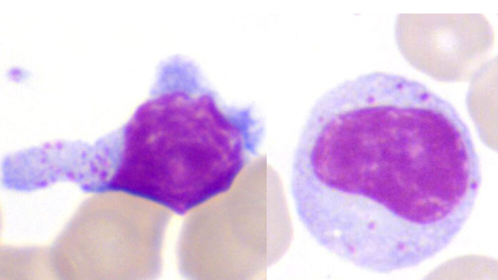 LGL_neu.jpg Typische LGL-Zelle