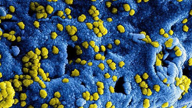 Middle East Respiratory Syndrome Coronavirus Labordiagnostik