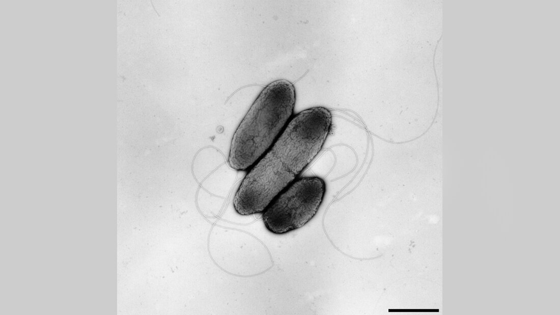Burkholderia pseudomallei