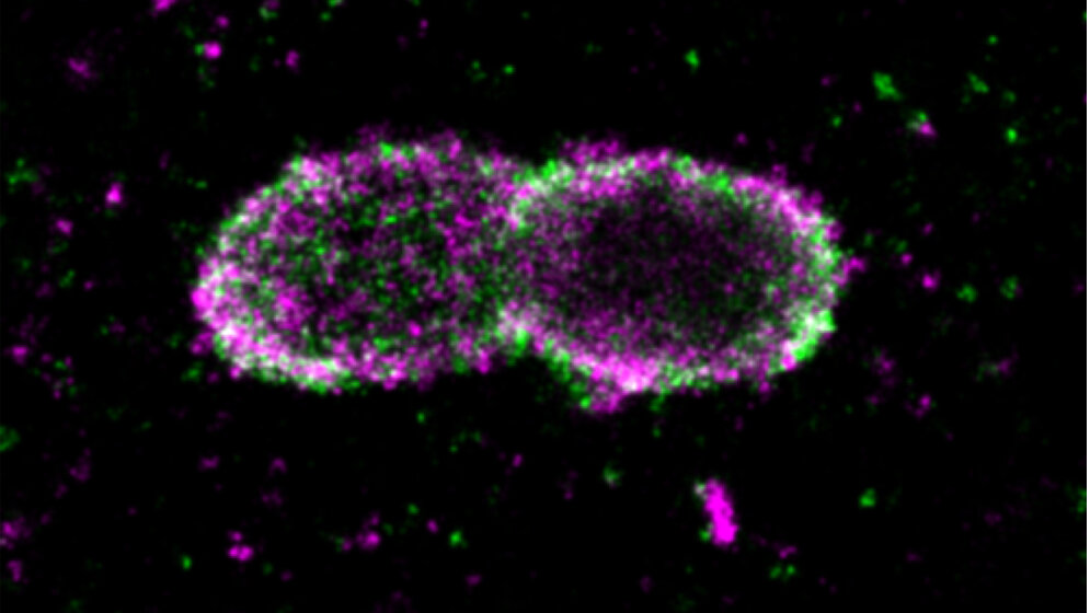 Salmonellen-Bakterien