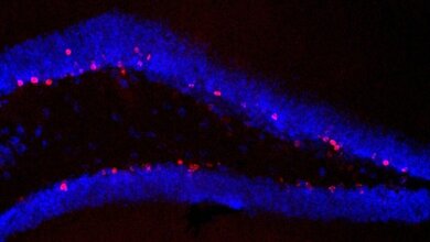 Hippocampus_unbehandelter_Tiere_die_trainiert_haben_Zahlreiche_Zellen_neu_rot_gebildet_Bild_Susanne_Wolf_MDC_20052016.jpg Hippocampus von unbehandelten Tieren