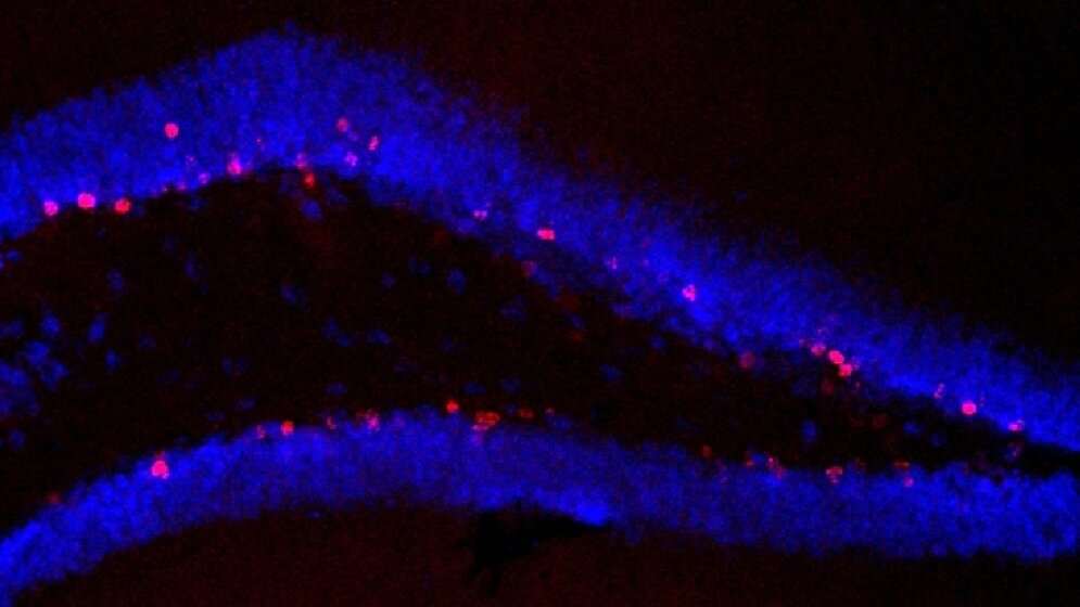 Hippocampus von unbehandelten Tieren