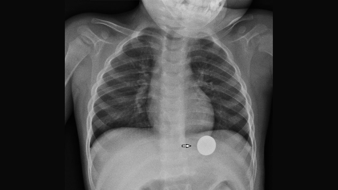 Titelbild des zweiten Teils der Fachbeitragsreihe über Artefakte bei bildgebenden Verfahren