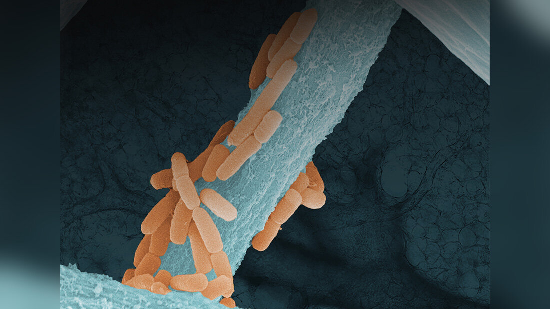 Ligilactobacillus murinus Aspergillus fumigatus