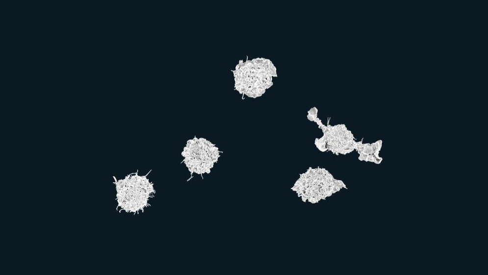 Makrophagen_NIAID_CC_BY_2_0_wikimedia.jpg Makrophagen