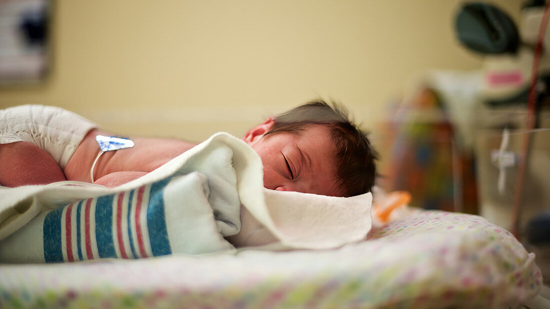 Neugeborene_MoCD.jpg Neugeborene MoCD Typ A