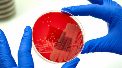 newsimage281208.jpgKeime.jpg Keime