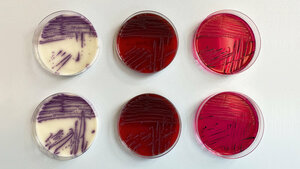Wachstum von Salmonella spp. auf RS-Agar, Blut-Agar und XLD-Agar (von links nach rechts).