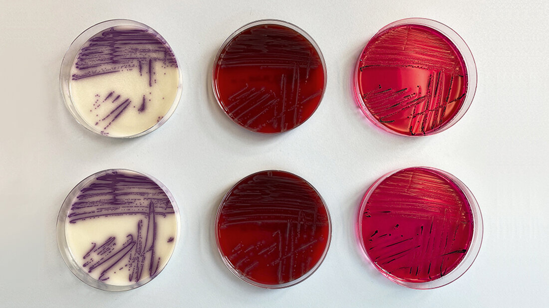 Wachstum von Salmonella spp. auf RS-Agar, Blut-Agar und XLD-Agar (von links nach rechts).