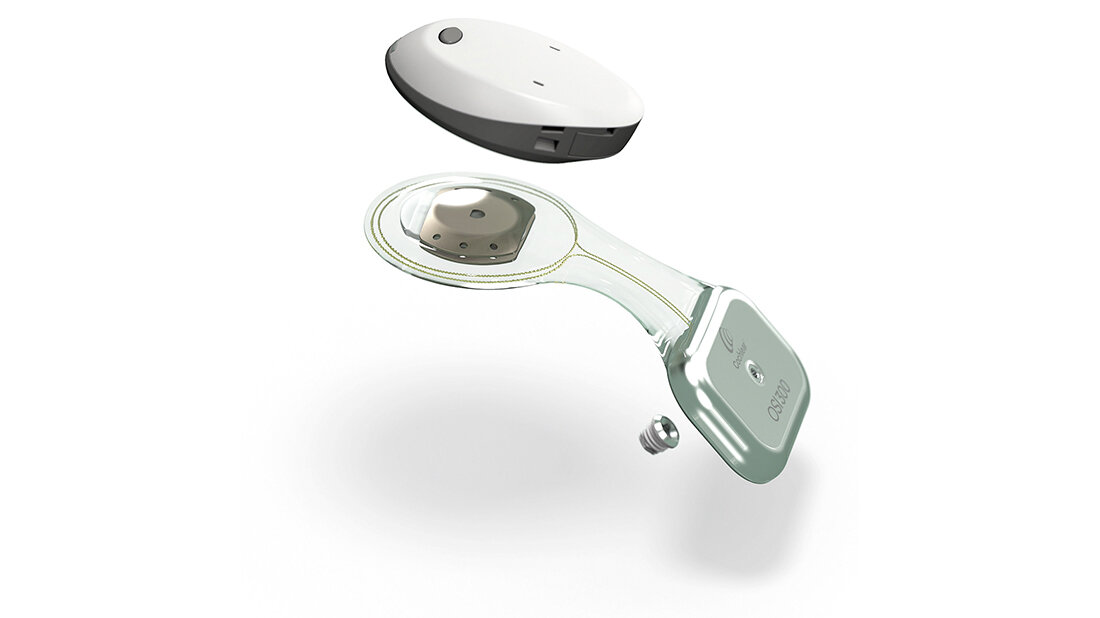 Die nächste Generation des
CochlearTM Osia® Systems Produktvorstellung des Cochlear™ Osia® Systems
