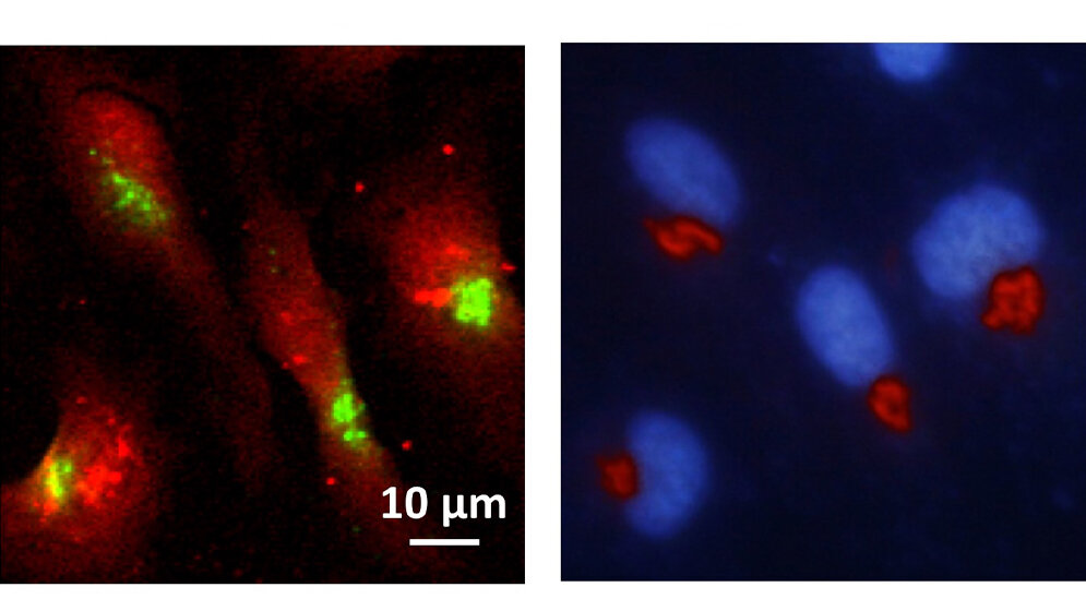Röntgenfluoreszensaufnahme und Epifluoreszenzaufnahme 