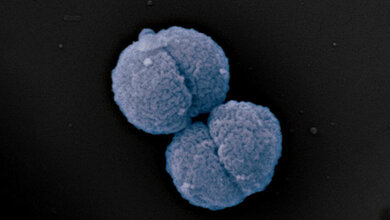 Neisseria gonorrhoeae (Gonokokken)