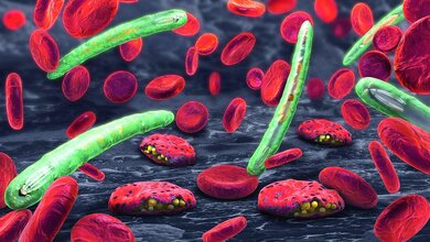 Darstellung von roten Blutkörperchen (Erythrozyten) und Plasmodien, den Erregern der Malaria