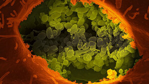 Titelbild zum Fachbeitrag über das sogenannte Q-Fieber