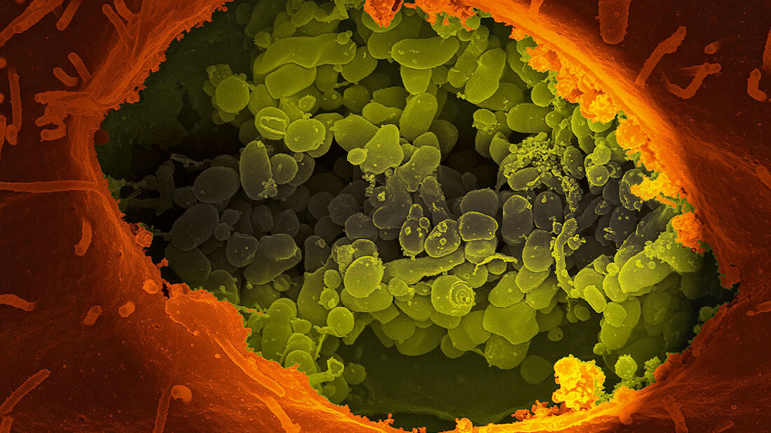 Titelbild zum Fachbeitrag über das sogenannte Q-Fieber